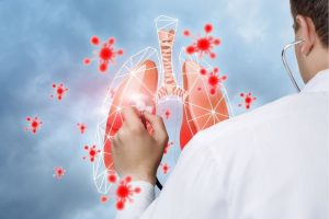 Mesleki Solunum Sistemi Hastalıkları